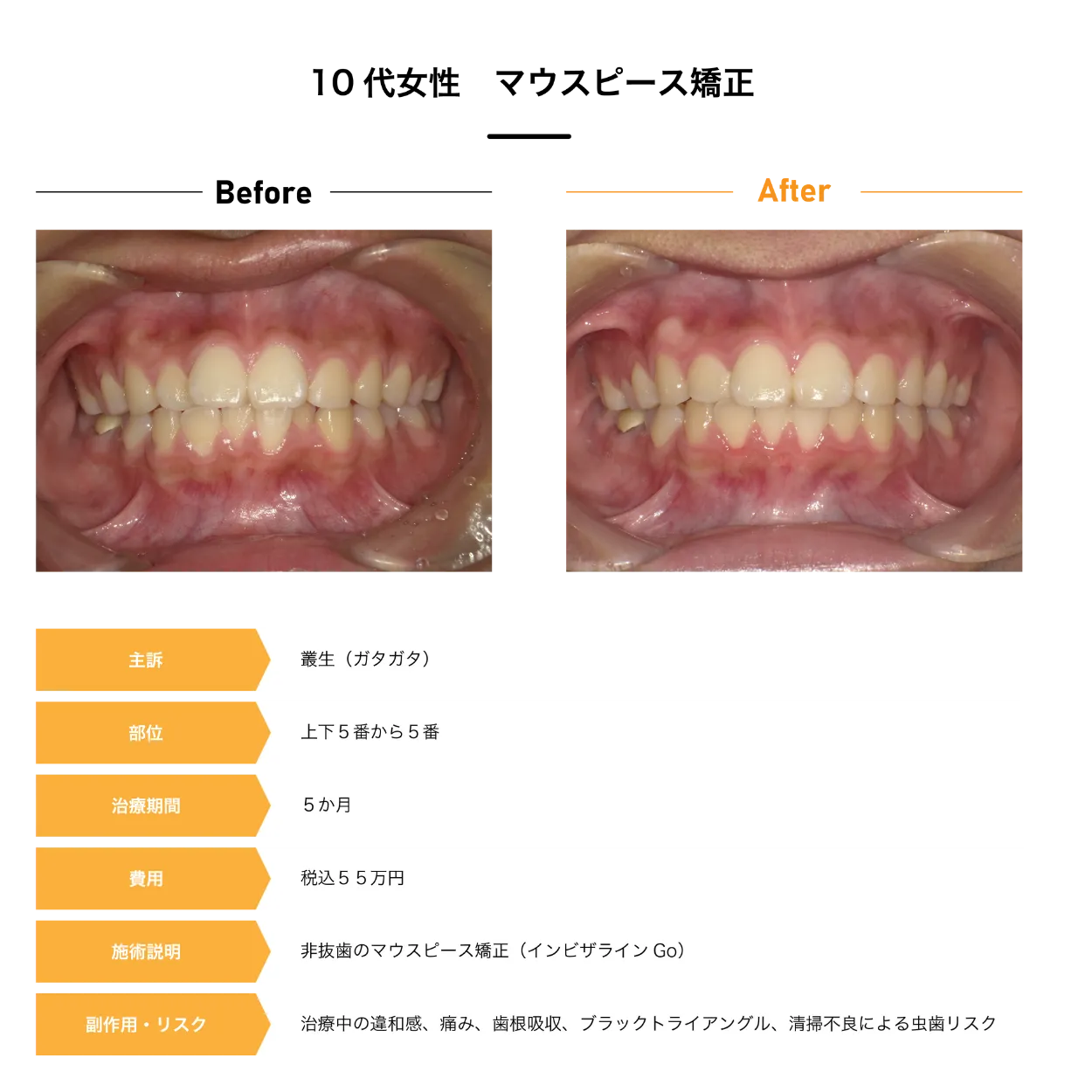 Case1