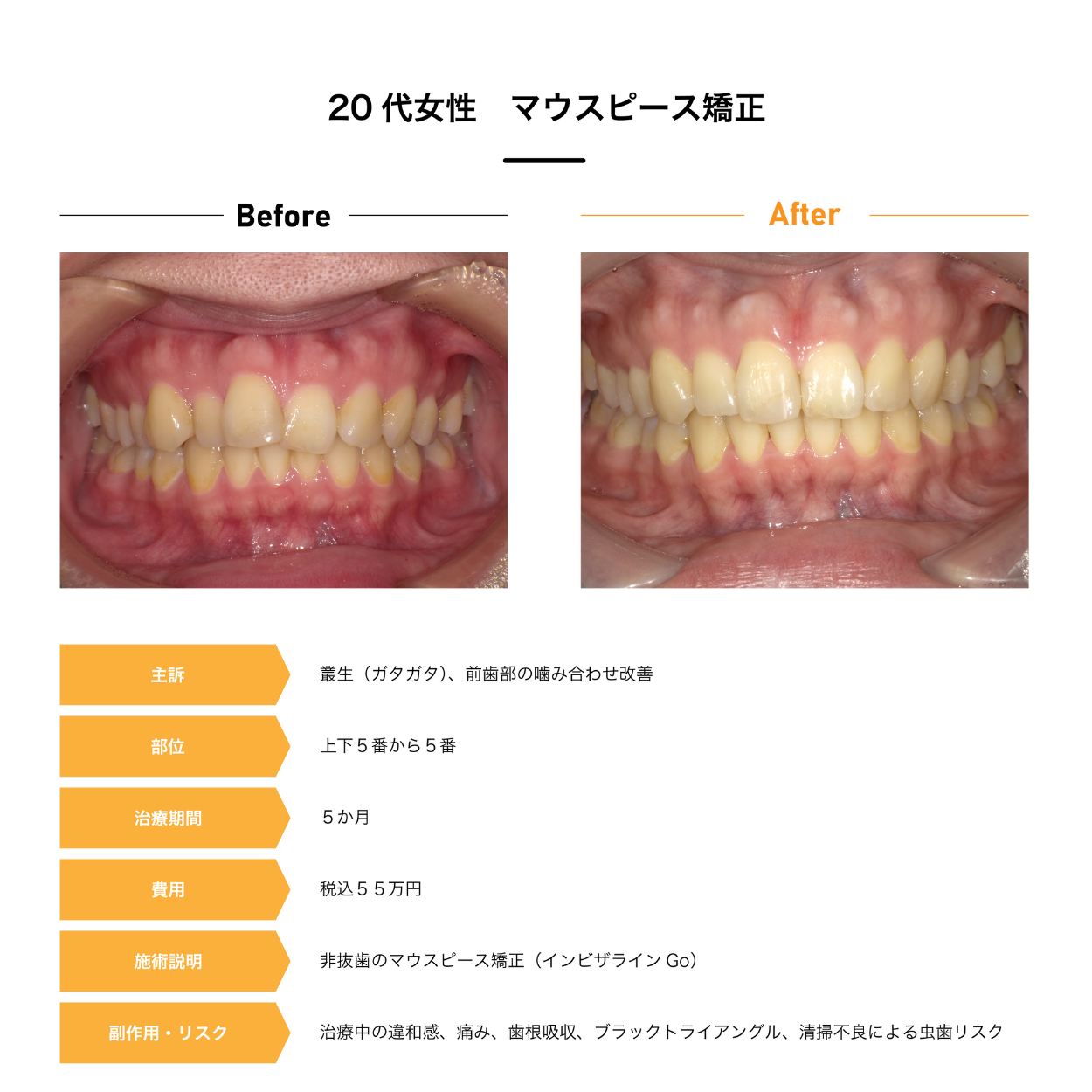 Case2