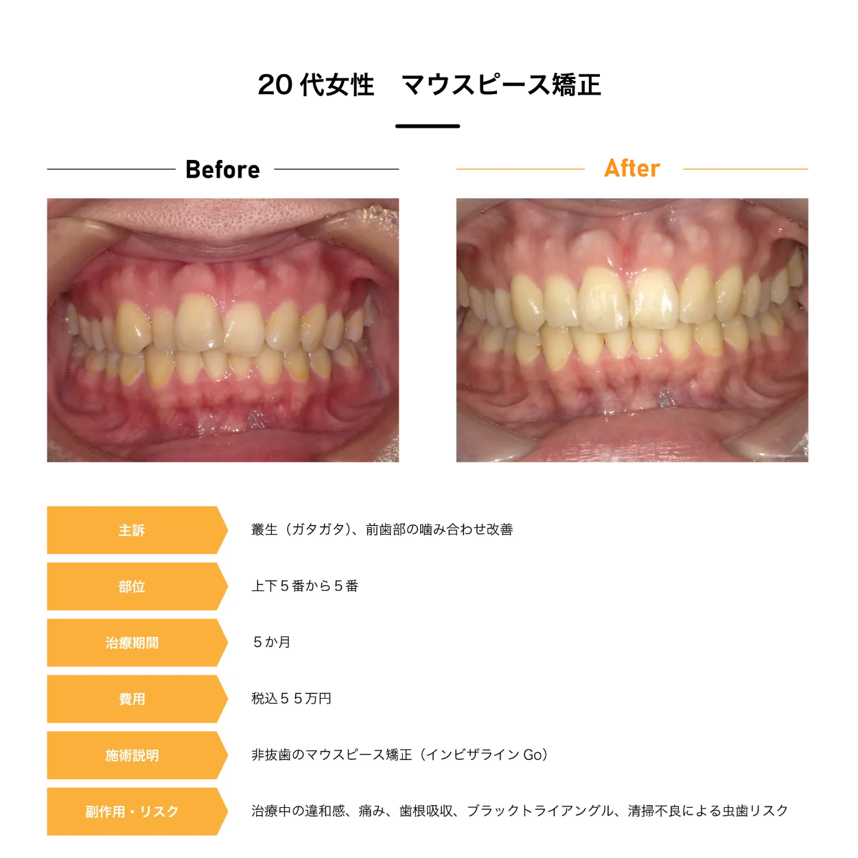 Case2