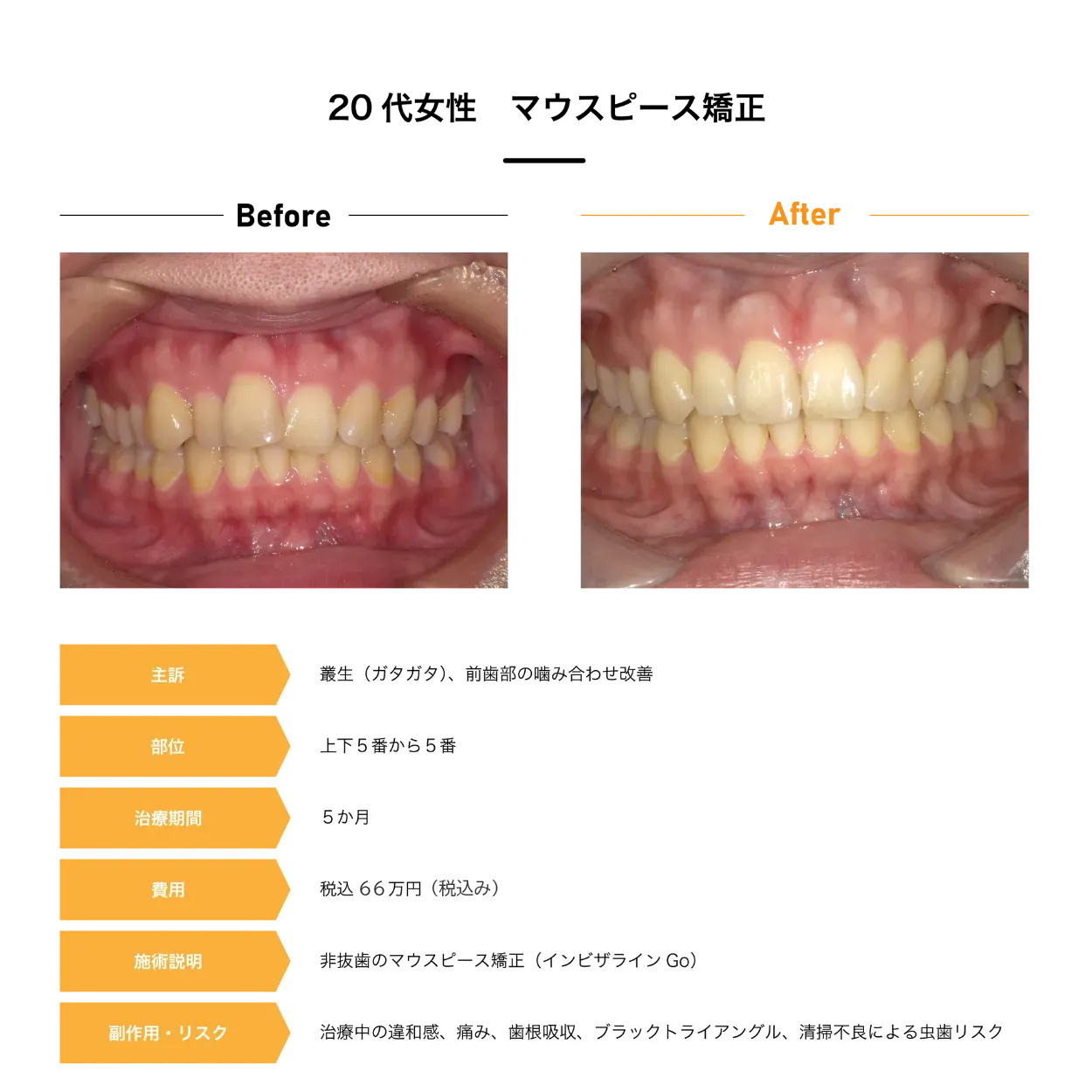 Case2
