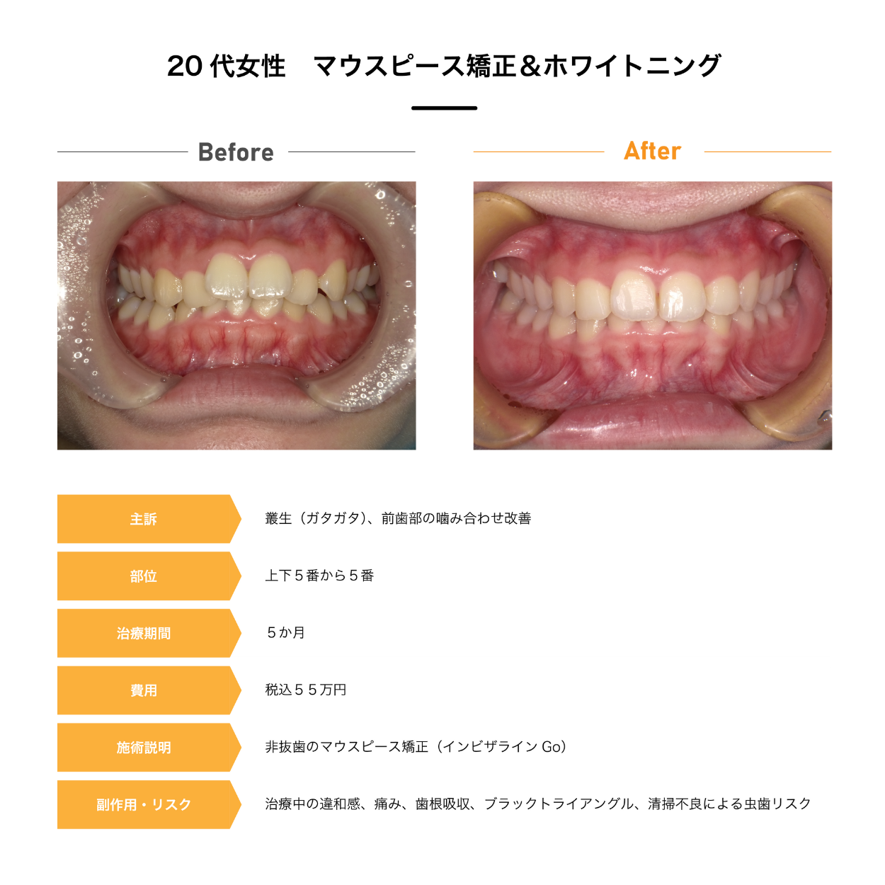 Case4