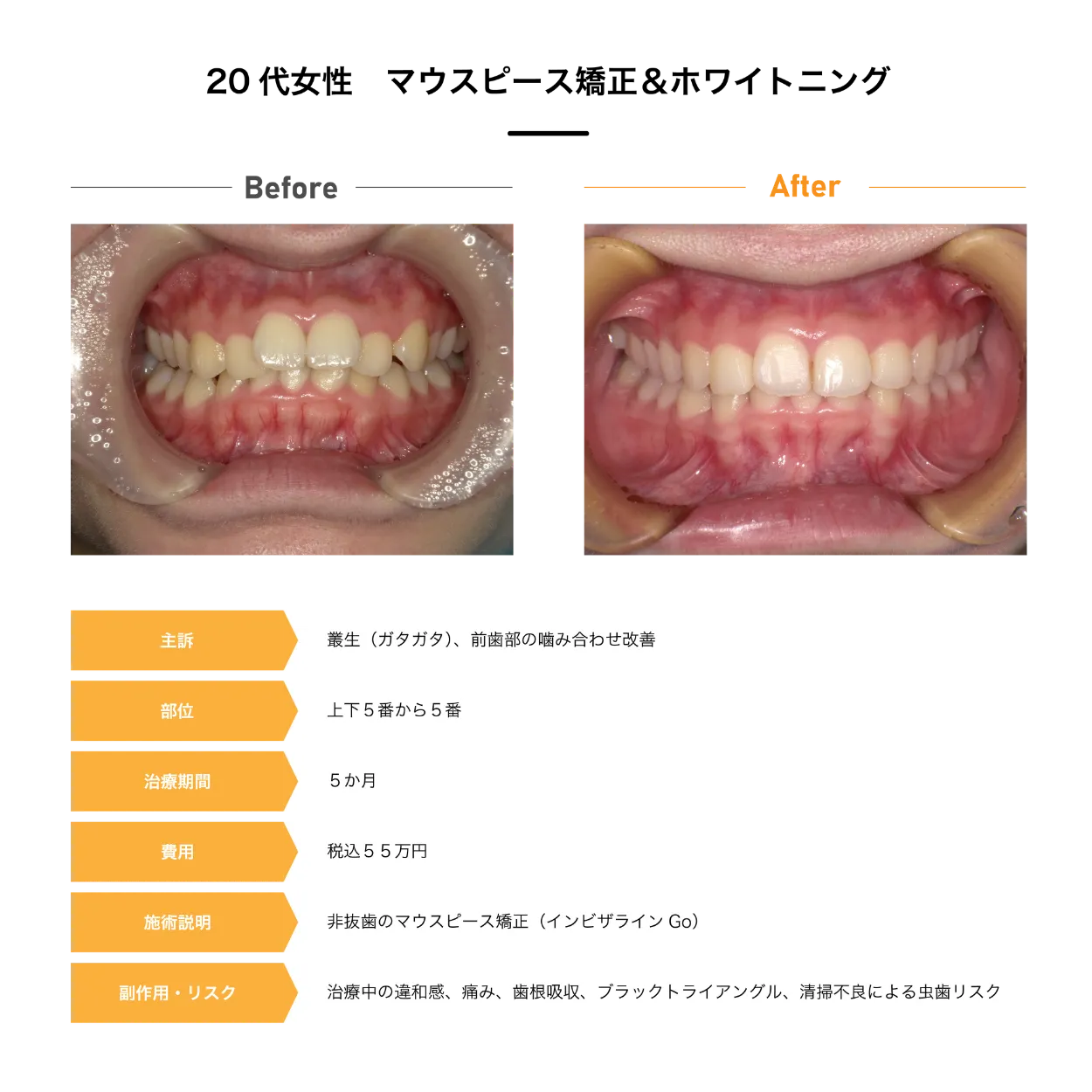 Case4